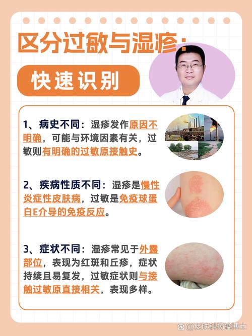 怎样区分过敏与其他疾病？教你准确判断过敏症状！