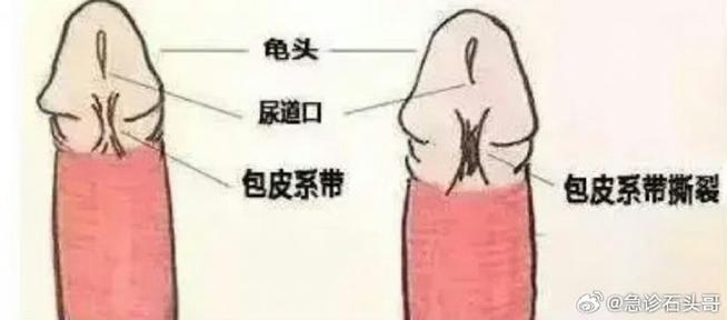 马刺是什么意思？别再误解了，快来了解一下！