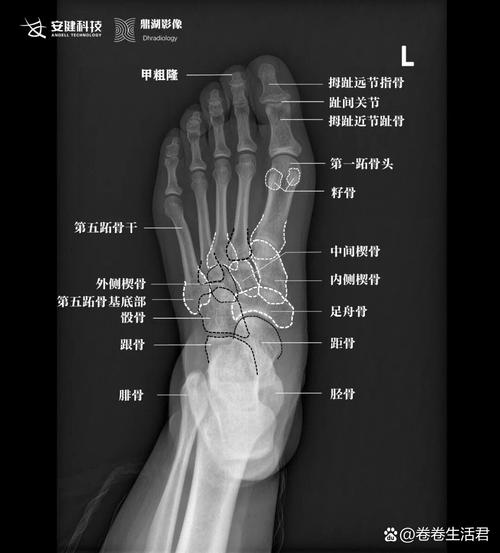深度剖析皮亚尼奇的足球水平，究竟是几流球员？
