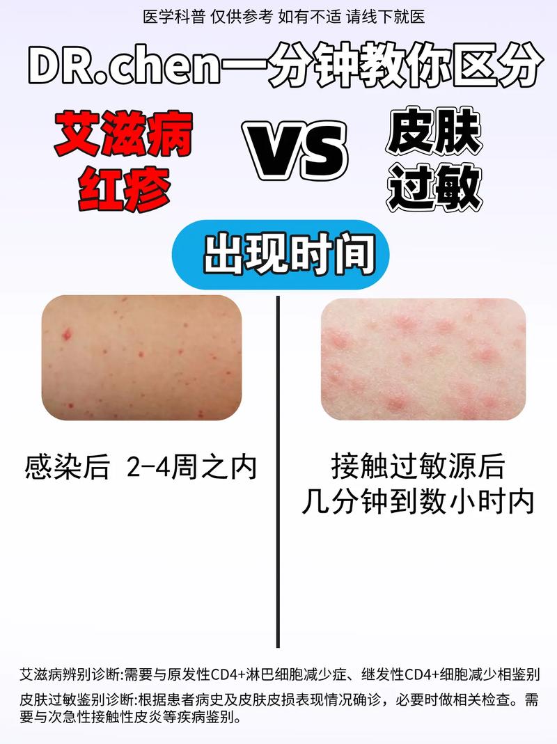 怎样区分过敏与其他疾病？教你准确判断过敏症状！