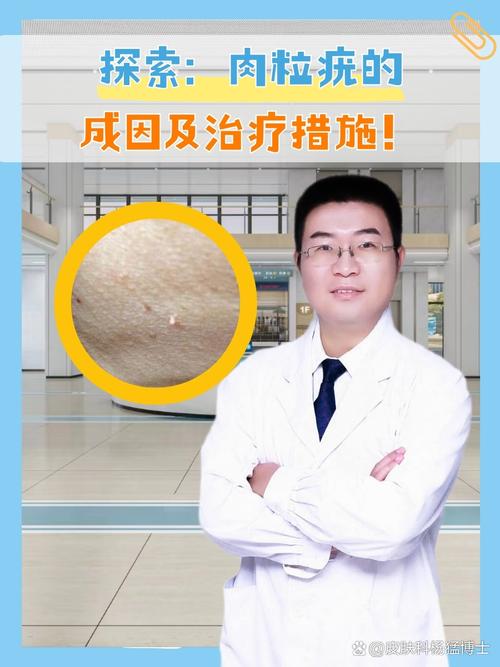 儿童青少年易患的尤文肉瘤是什么？深度解析