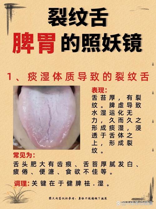 为什么我的舌头会有裂纹？中医和西医的解释及治疗方案
