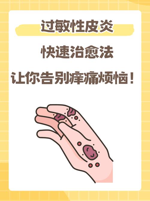 如何治愈过敏性皮炎？过敏性皮炎的治疗方法及预防
