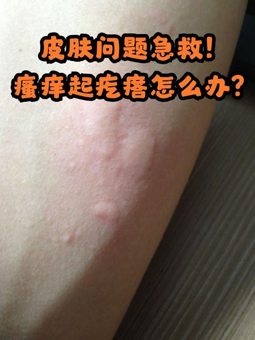皮肤过敏红痒的急救处理方法，快速缓解你的不适