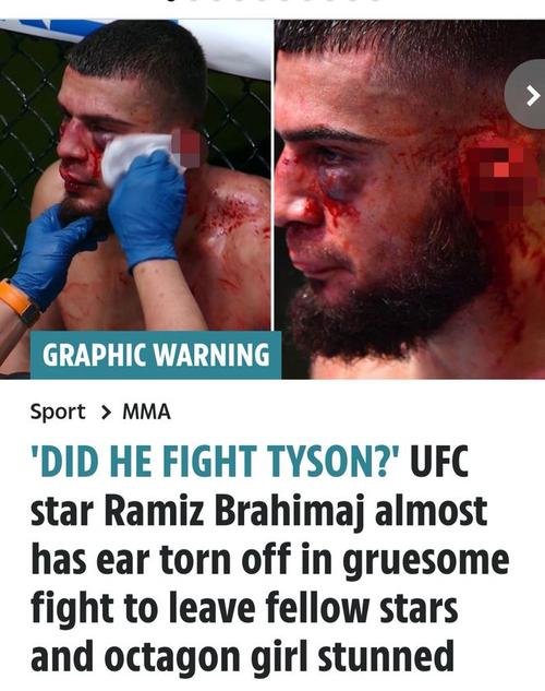 UFC输几场被开除？选手连败的残酷现实