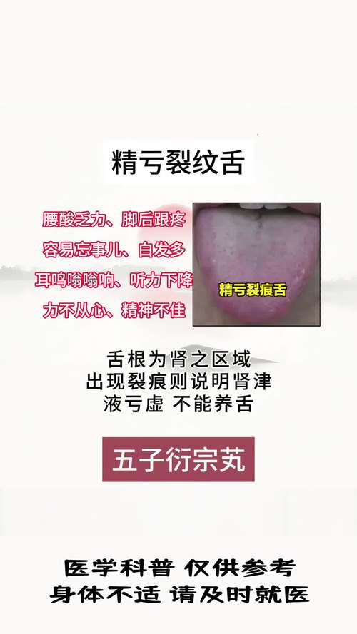 为什么我的舌头会有裂纹？中医和西医的解释及治疗方案