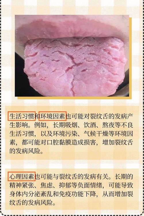 为什么我的舌头会有裂纹？中医和西医的解释及治疗方案