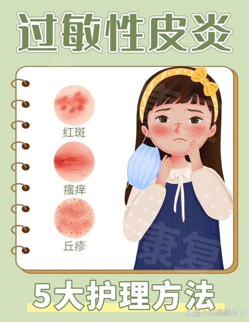 如何治愈过敏性皮炎？过敏性皮炎的治疗方法及预防