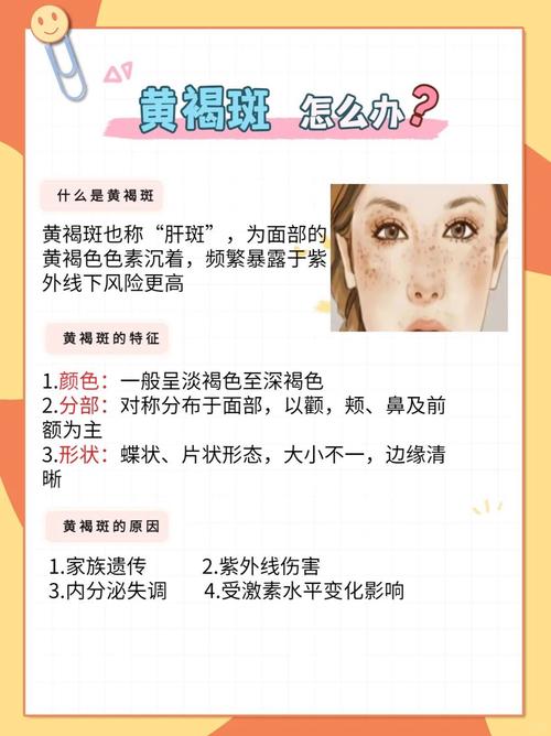 满脸雀斑去除方法有哪些？快速淡斑小技巧