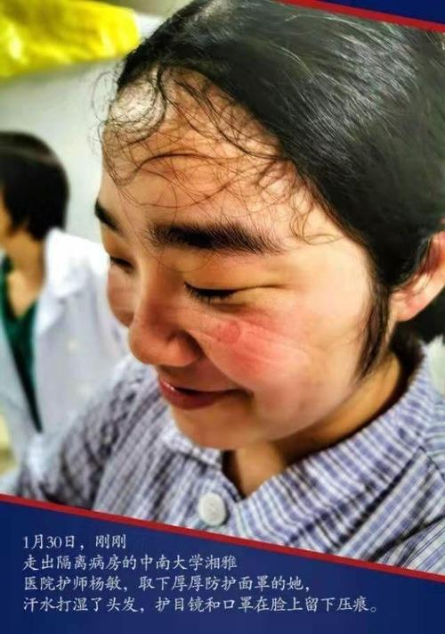 尤文氏肉瘤能治愈吗？治愈率高吗？