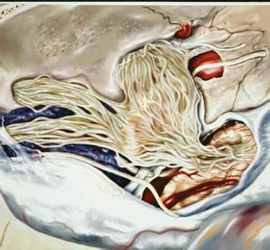 尤文氏肉瘤能治愈吗？治愈率高吗？