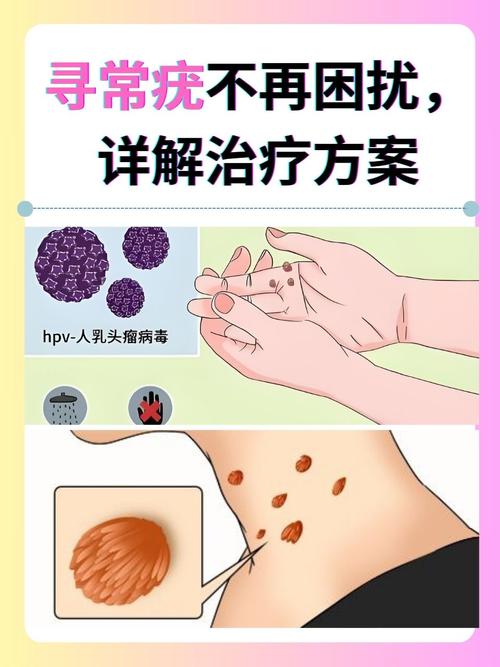 尤文氏肉瘤的治疗方法有哪些？会是绝症吗？