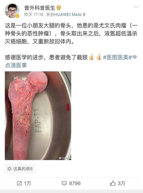 尤文氏肉瘤的治疗方法有哪些？会是绝症吗？