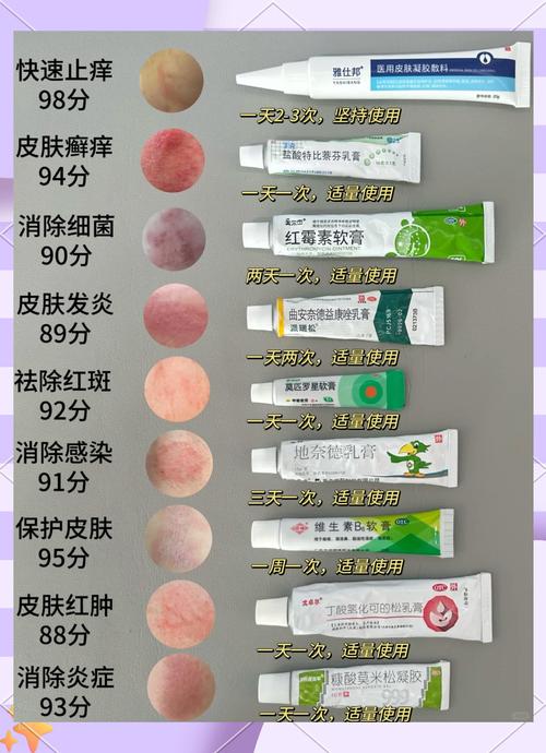 如何治愈过敏性皮炎？过敏性皮炎的治疗方法及预防
