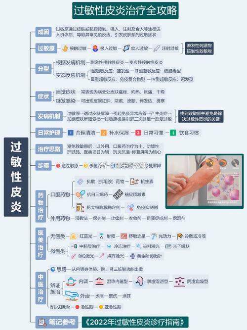 如何治愈过敏性皮炎？过敏性皮炎的治疗方法及预防