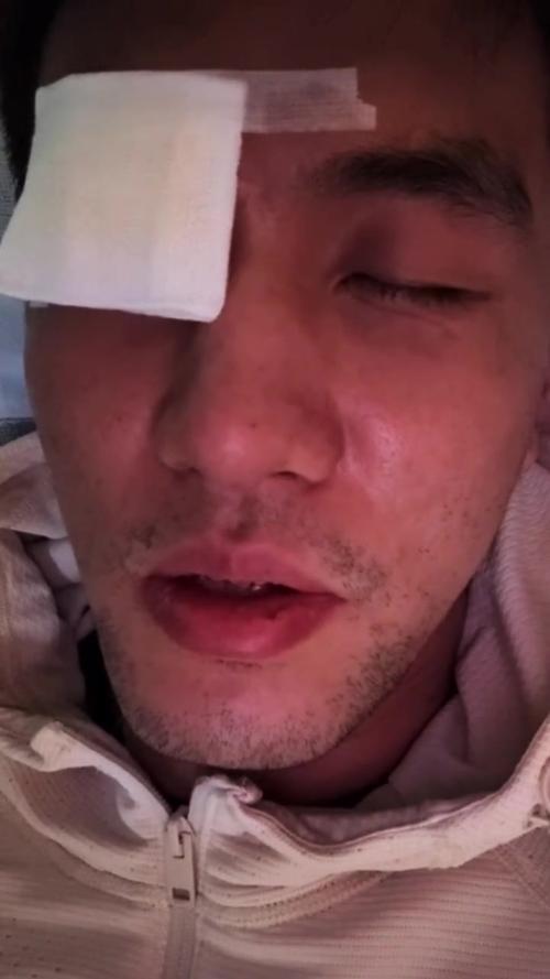 揭秘郭艾伦事件：受伤、回应及各方态度解读