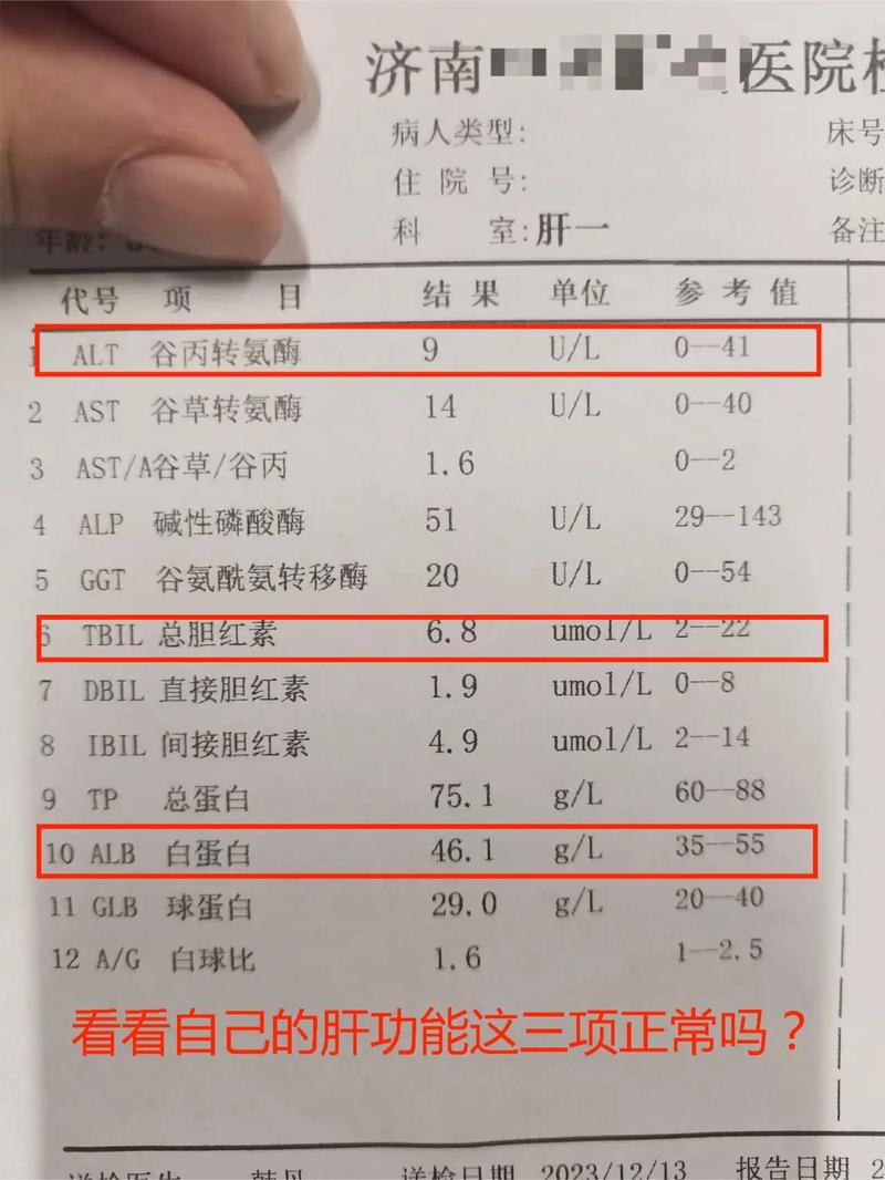 想做肝功能检查？先了解有哪些必检项目
