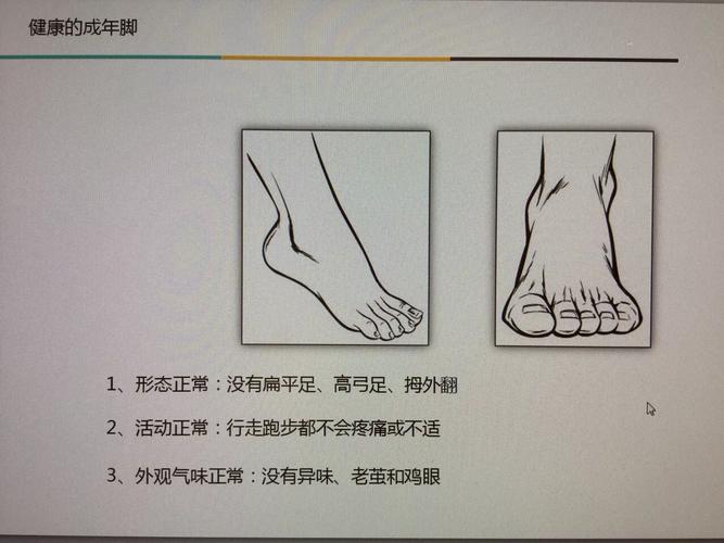 每天莫名其妙哈哈大笑正常吗？当心影响健康的5种情况