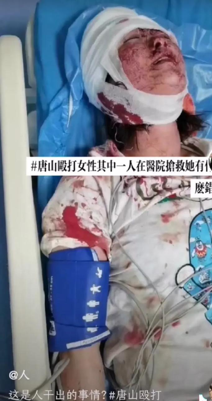 唐山被打女子去世是谣言吗？医院辟谣事实曝光！