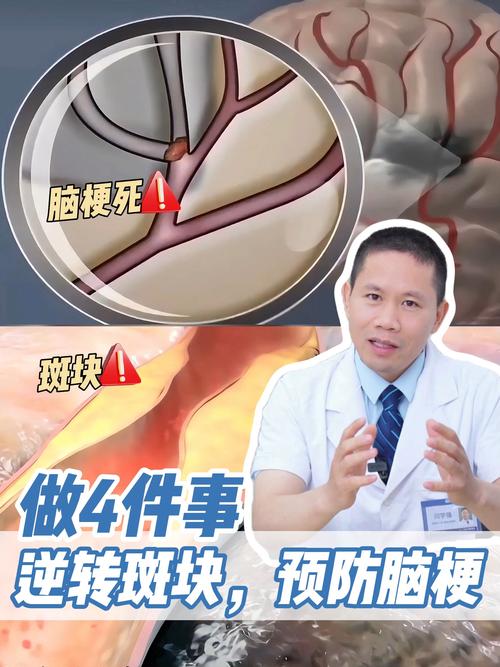 脑残的eca怎么回事?资深从业者揭秘深层原因