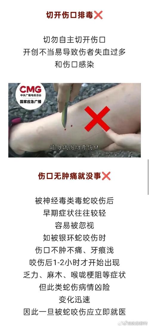 逗蛇被咬蛇死亡后的急救？实用处理步骤介绍